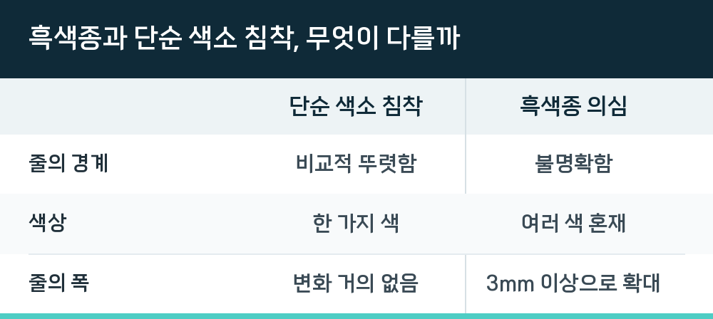 흑색종과 단순 색소 침착, 무엇이 다를까